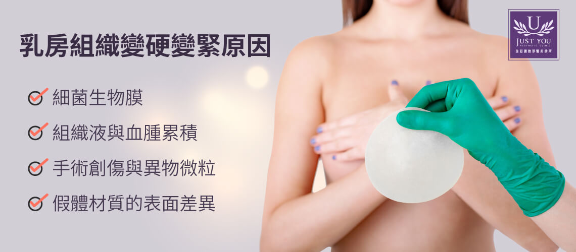 為什麼乳房組織會變硬變緊的四大原因：1.細菌生物膜  2.組織液與血腫積累 3.手術創傷與異物微粒  4.假體材質的表面差異