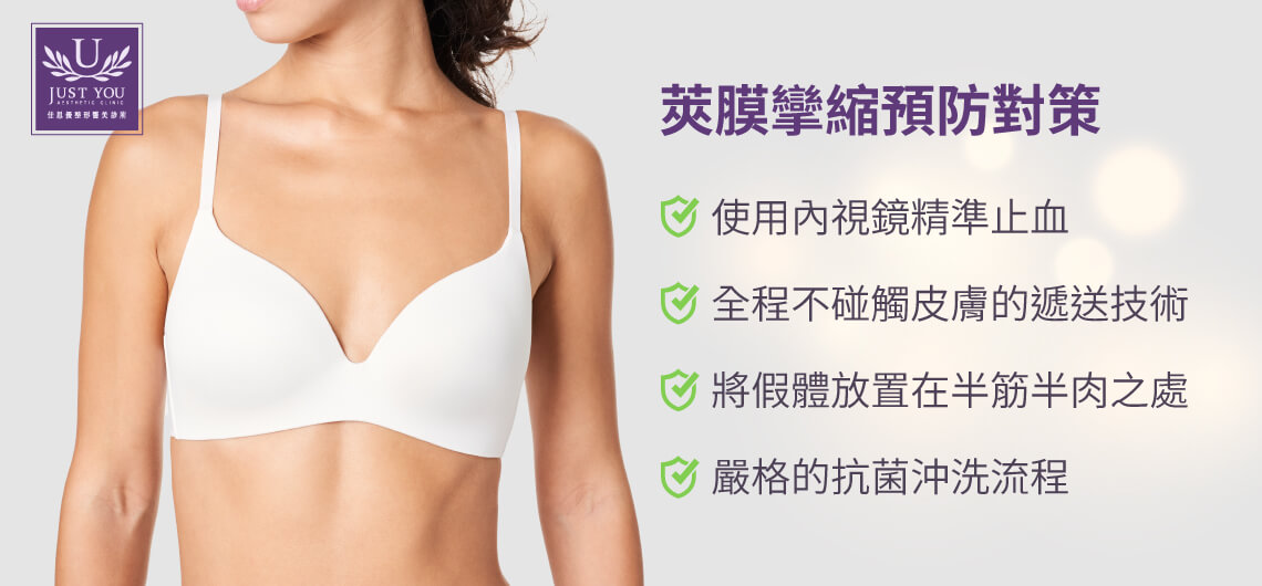 隆乳想要柔軟自然的成果，預防勝於治療 ✦使用內視鏡精準止血  ✦ 全程不碰觸皮膚的遞送技術 ✦ 將假體放置在半筋半肉之處✦ 嚴格的抗菌沖洗流程