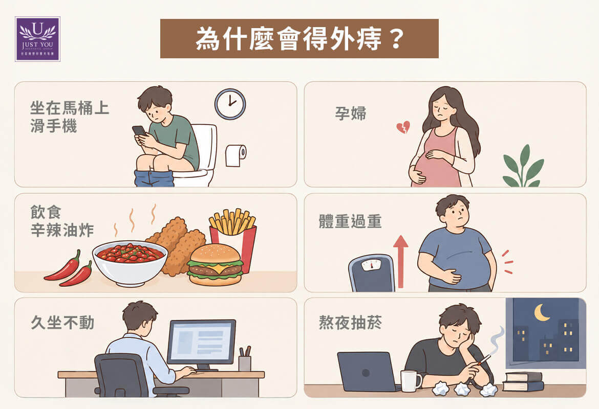 為什麼會得外痔？解析 6 大常見誘發成因  &bull;不良排便習慣 &bull;久坐久站與長時間如廁 &bull; 懷孕與分娩 &bull; 飲食與體重因素 &bull;生活作息與其他疾病 &bull;	家族史