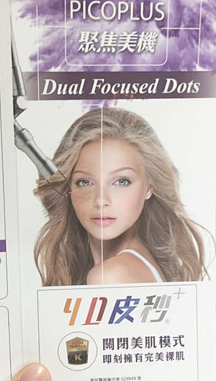 4D皮秒雷射改善毛孔粗大、淡化斑點、改善膚色不均