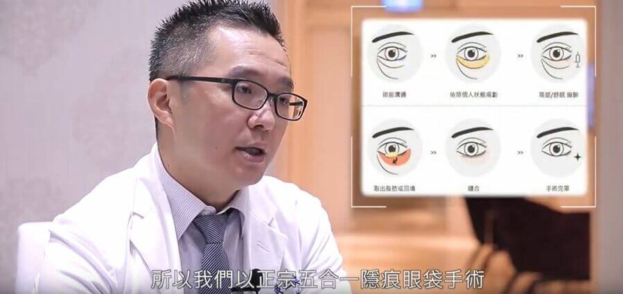 黄仁吴医师「五合一隐痕眼袋手术」5大特色