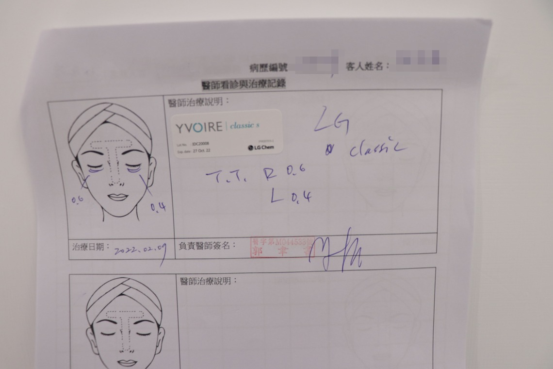 佳思優整形醫美診所微整形專家郭聿書醫師玻尿酸補淚溝病歷