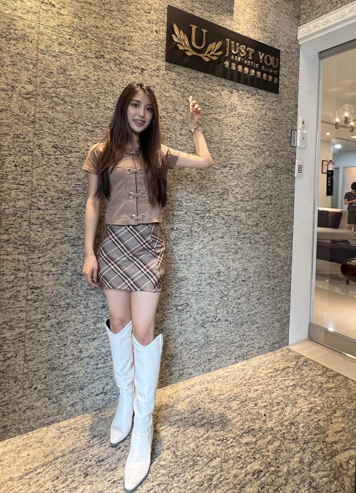 佳思優整形醫美診所微整形專家郭聿書醫生玻尿酸補淚溝治療後一個月