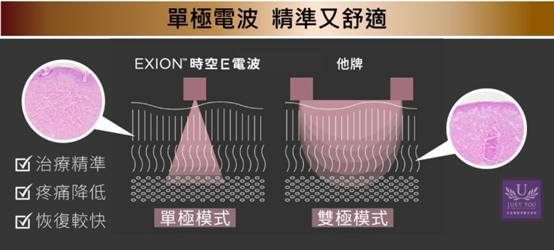 時空E電波-敦北佳思優與他牌比較