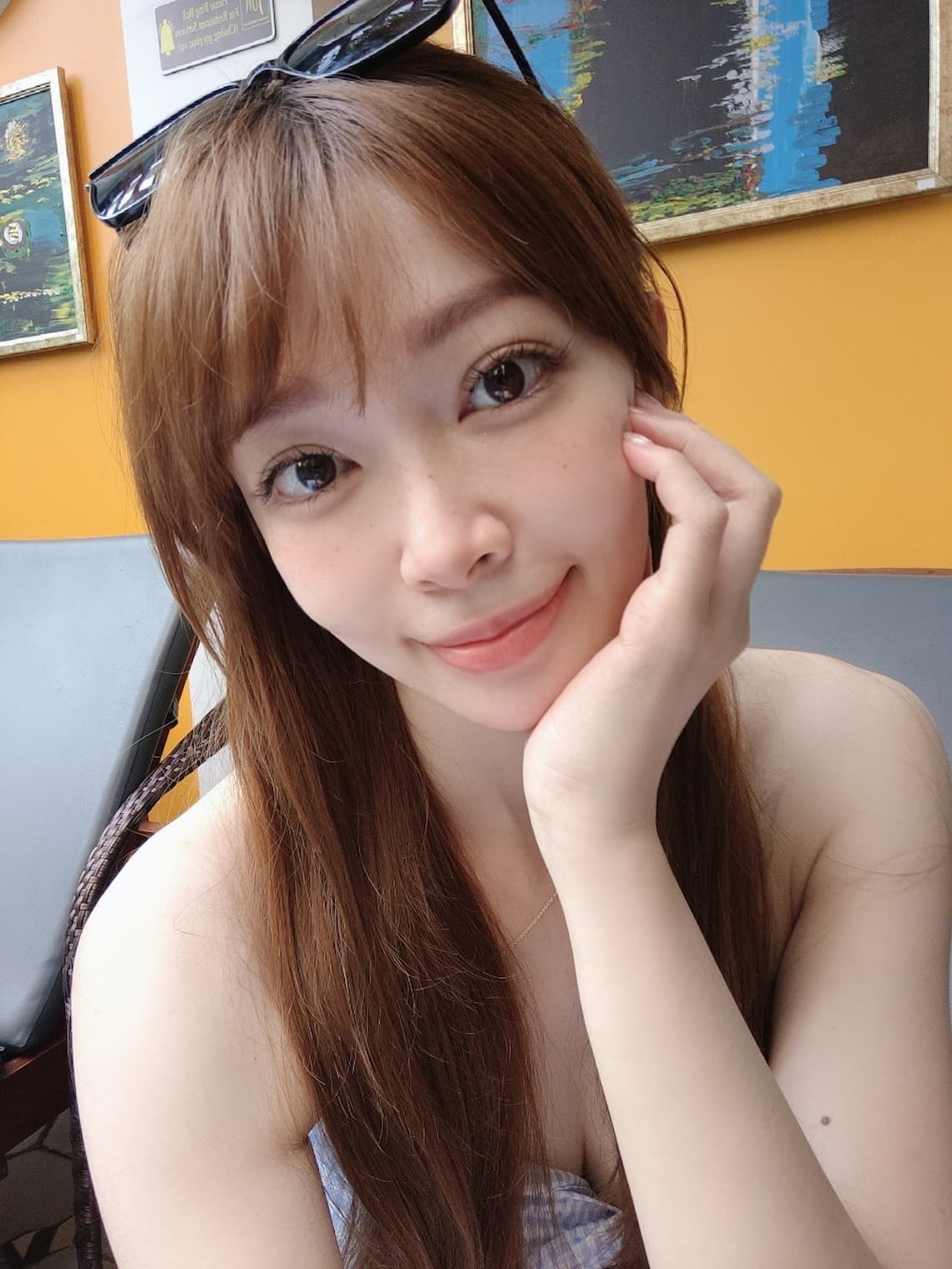 玻尿酸淚溝治療-台中醫美診所佳思優