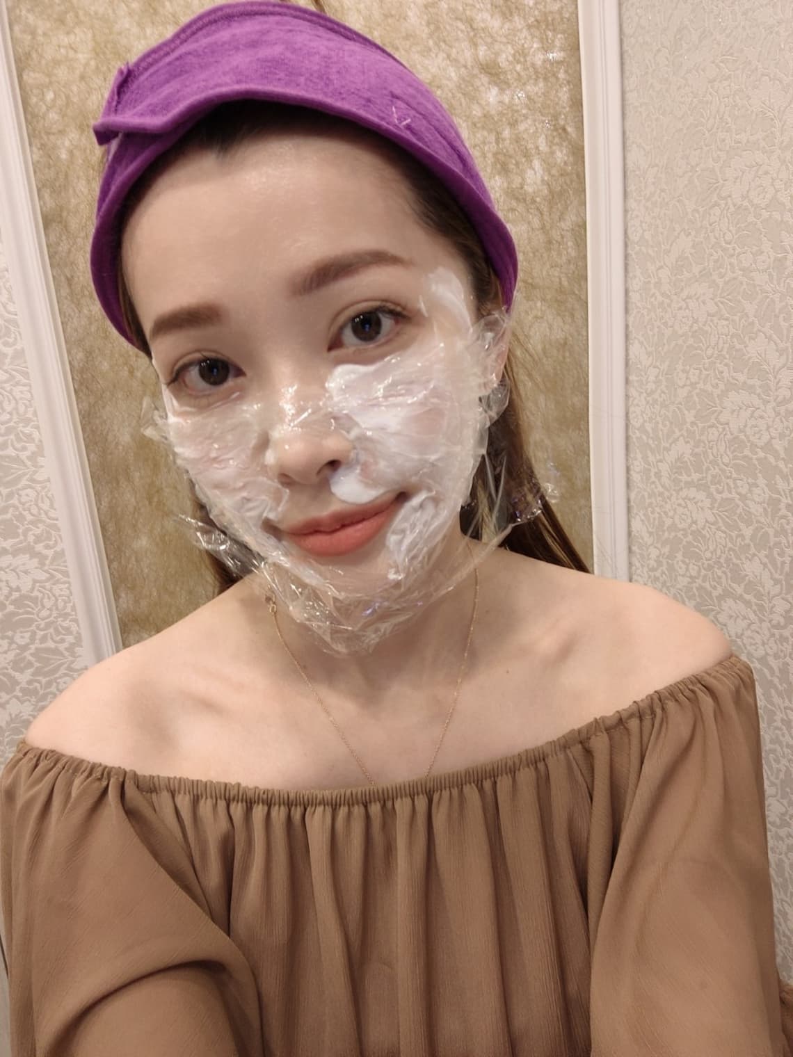 施打玻尿酸淚溝術前敷麻藥