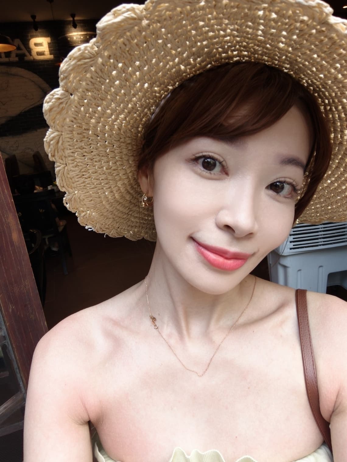 在台中醫美診所佳思優施打完玻尿酸一周後記錄
