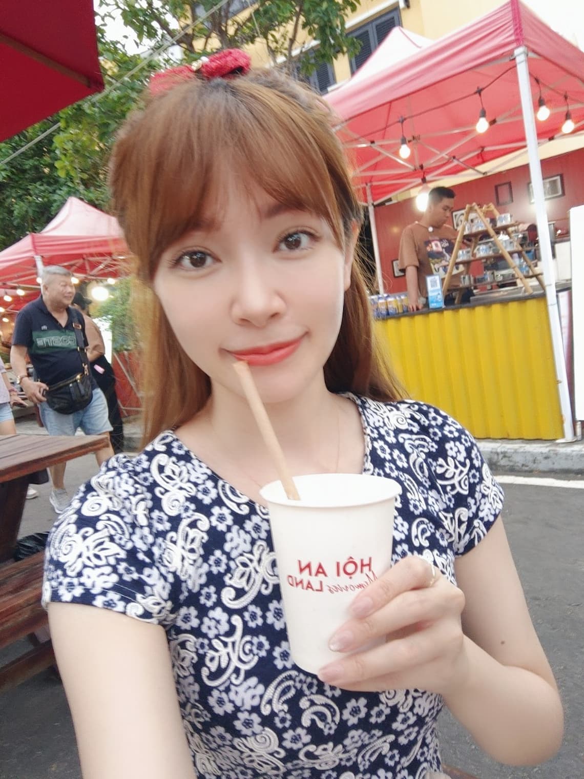 在台中醫美診所佳思優施打完玻尿酸兩周後記錄