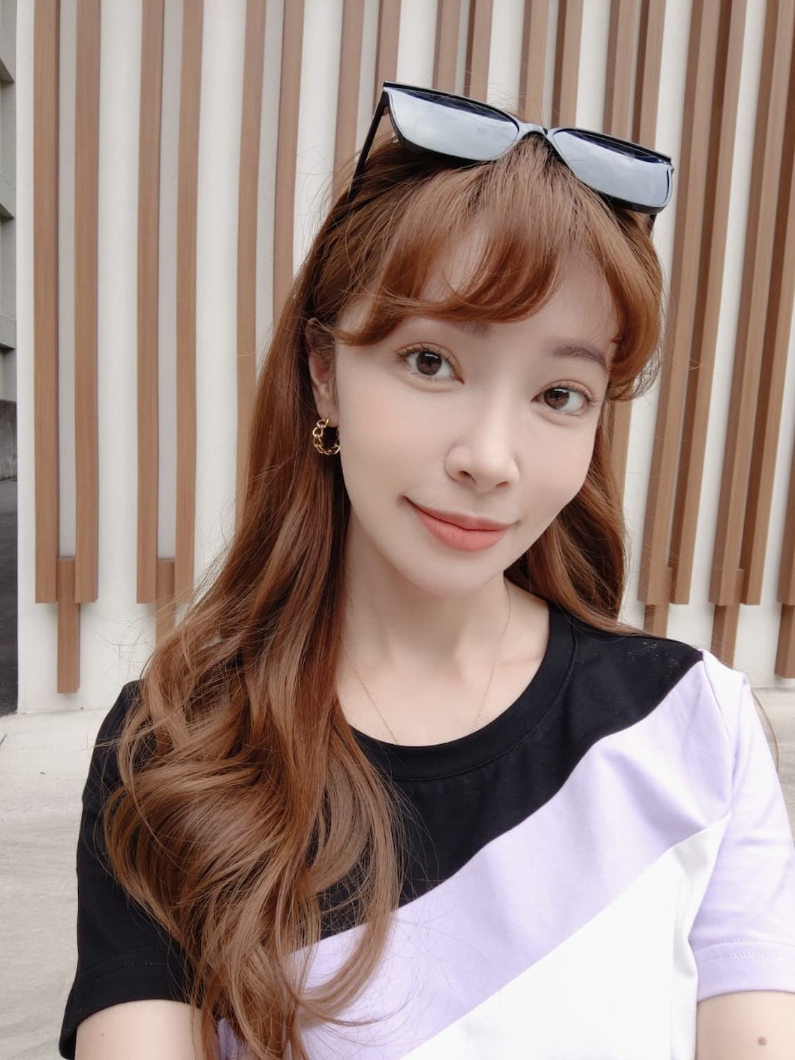 在台中醫美診所佳思優施打完玻尿酸兩周後記錄