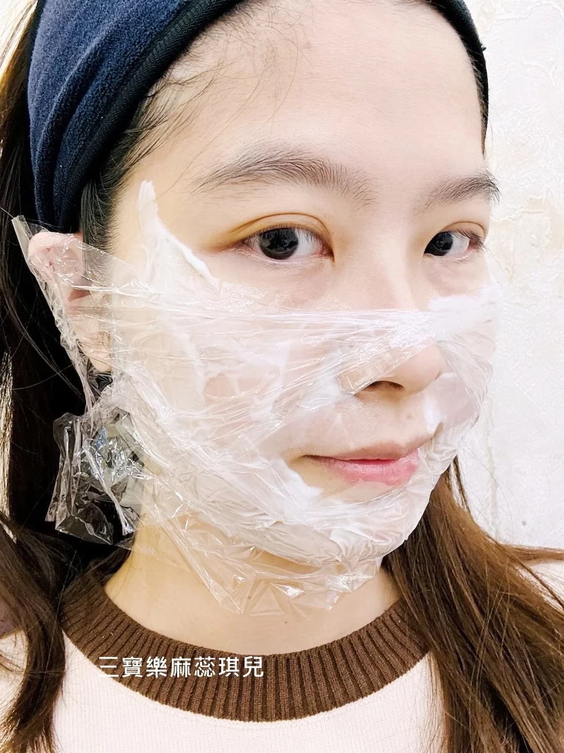 台中醫美佳思優診所新倍提電音雙波施打前敷麻藥