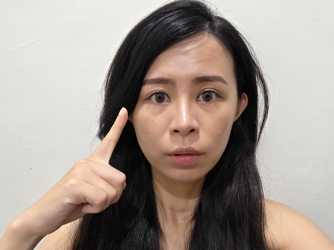 美音二代-佳思优敦北术后一周分享