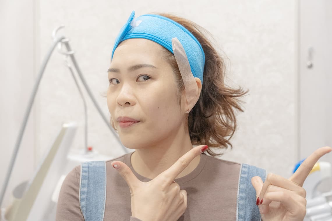 台中佳思優診所-施打Z音波立即術後拍照對比