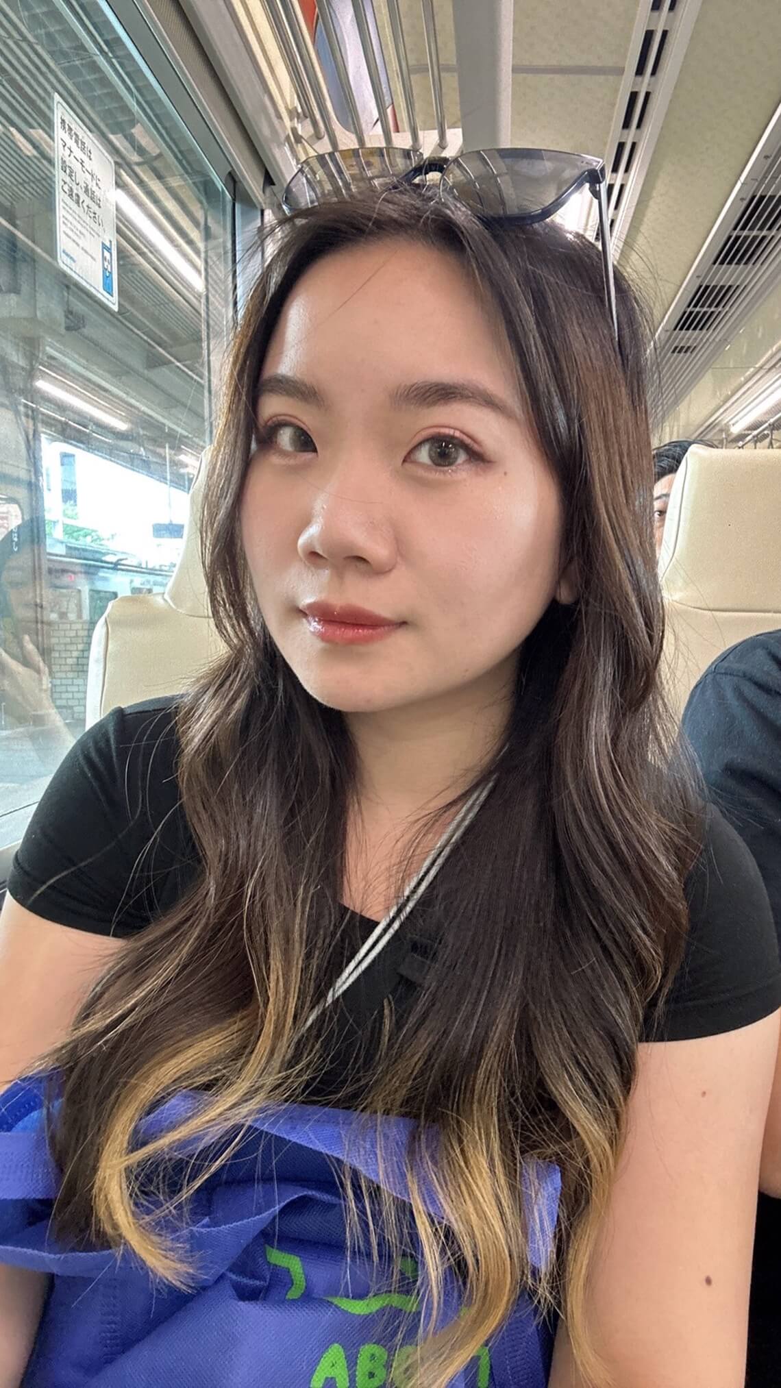 美国音波二代-佳思优术后分享生活