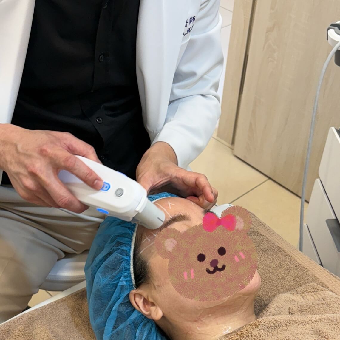 美音二代-佳思优治疗过程