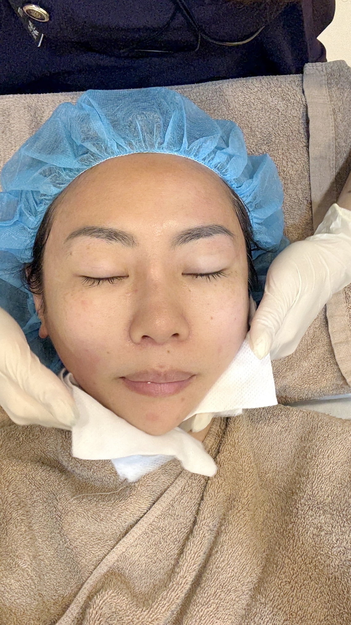 二代美国音波-佳思优敦北术后镇定