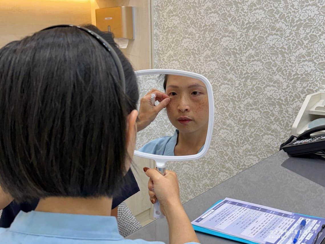 佳思優醫美診所給整形外科陳依凡醫師在施作五合一眼袋手術前，仔細的評估我眼下的脂肪分布結構與肌膚鬆弛問題