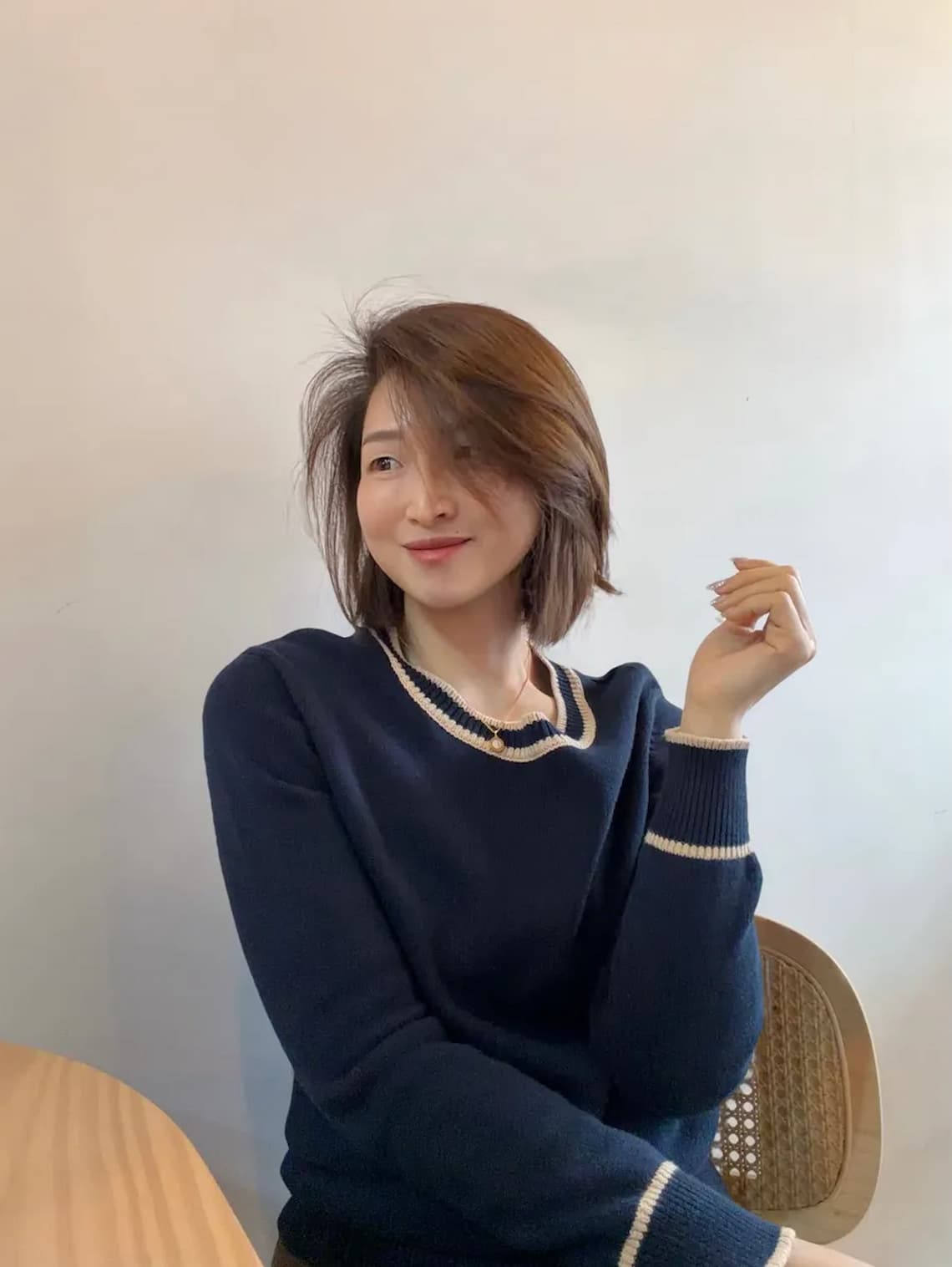 在佳思優整形外科診所的陳依凡醫師做眼袋手術後，眼下自然飽滿，非常滿意