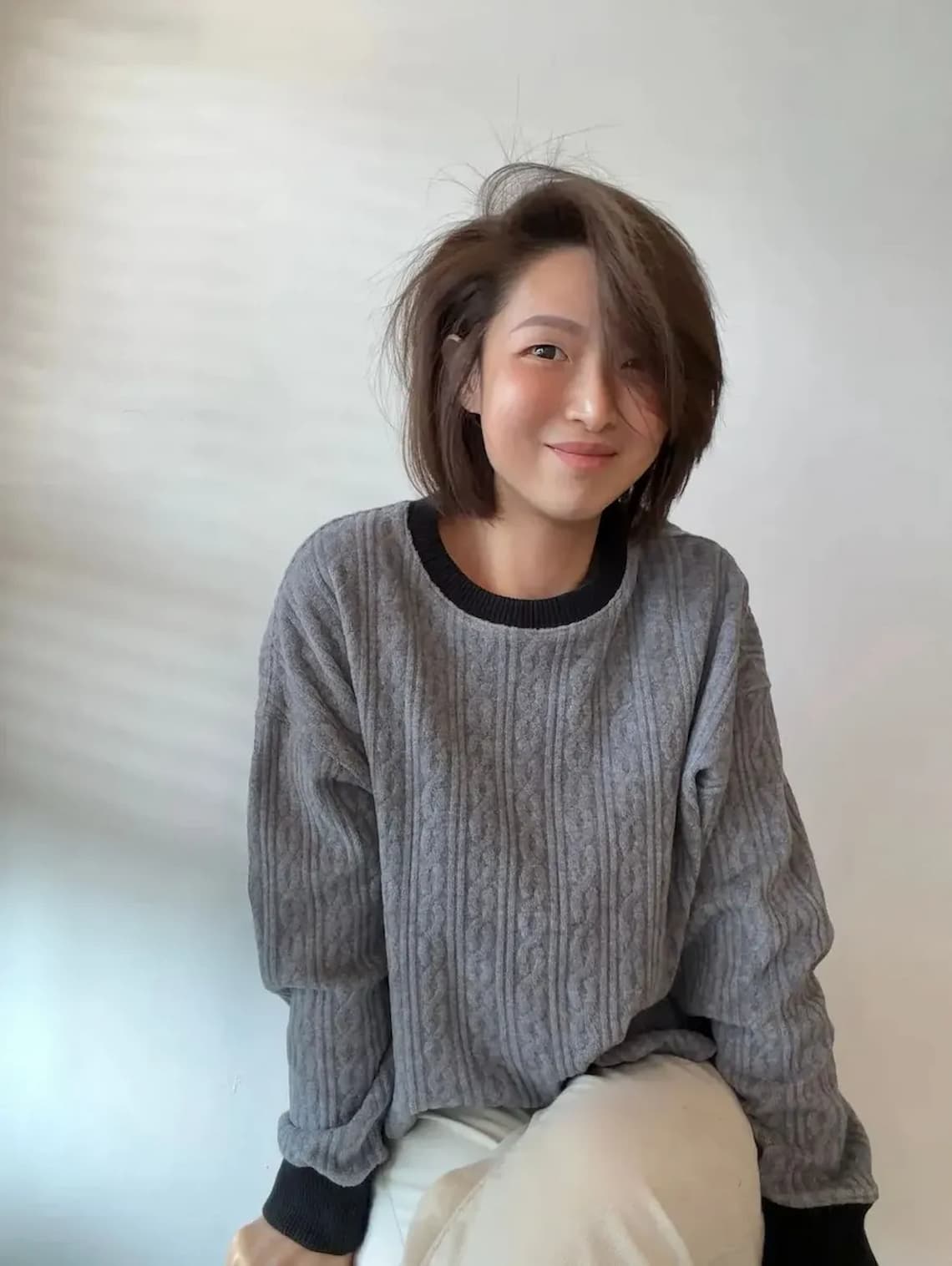 在佳思優整形外科診所的陳依凡醫師做眼袋手術後，眼下自然飽滿，非常滿意