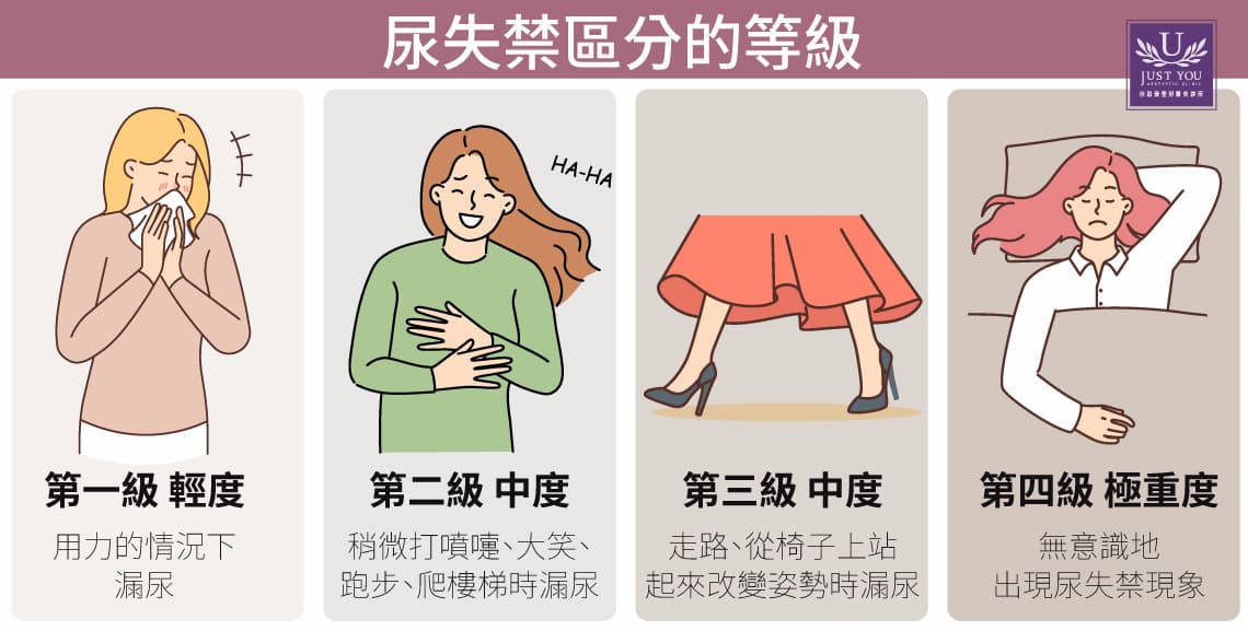 產後媽媽有可能產生的私密處問題，分為四級。其中漏尿跟尿失禁是常見的困擾。