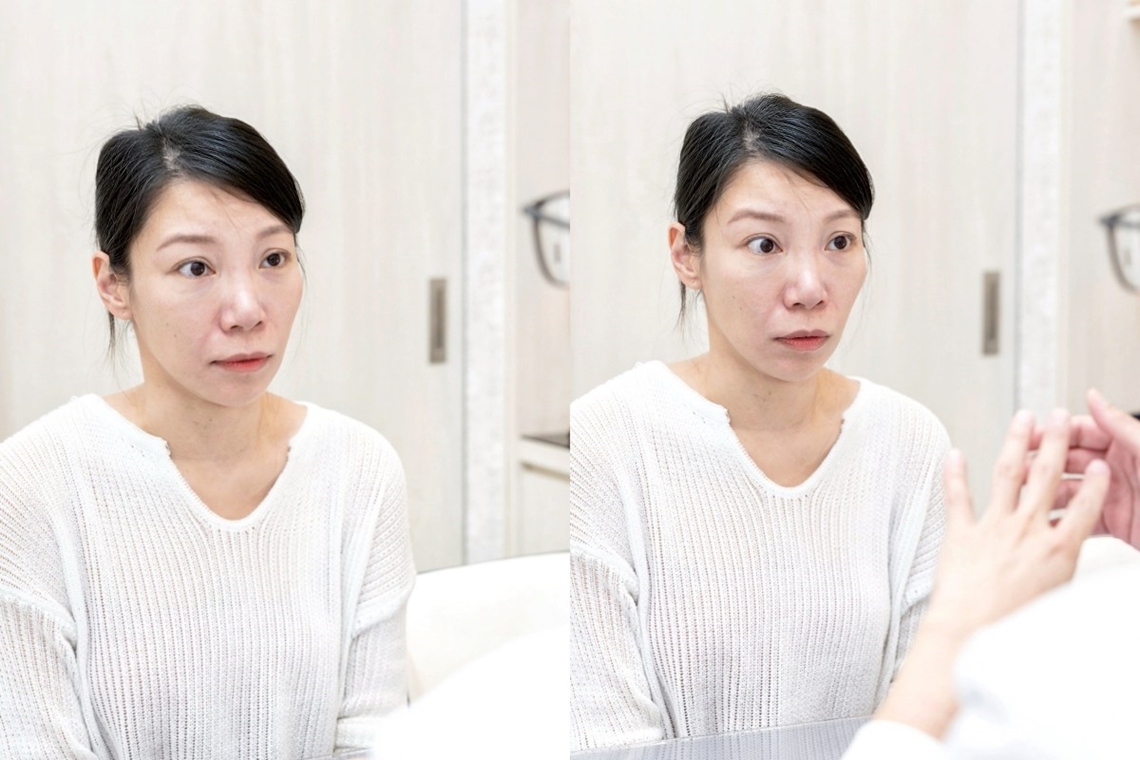 竹北佳思优李嘉骏医师说明弹力针跟逆时针可以做到哪些改变！