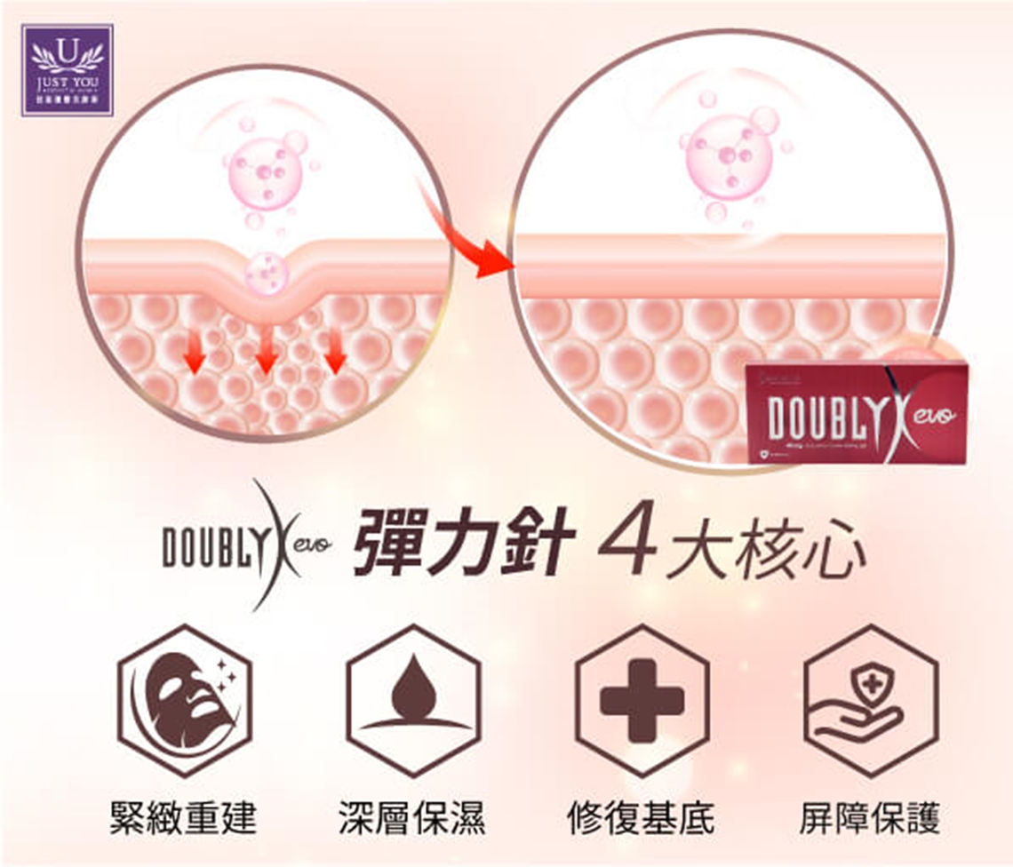 佳思优竹北Doublyx evo弹力针属于另一种概念。弹力针的全名叫「爱肤倍增凝胶玻尿酸」
